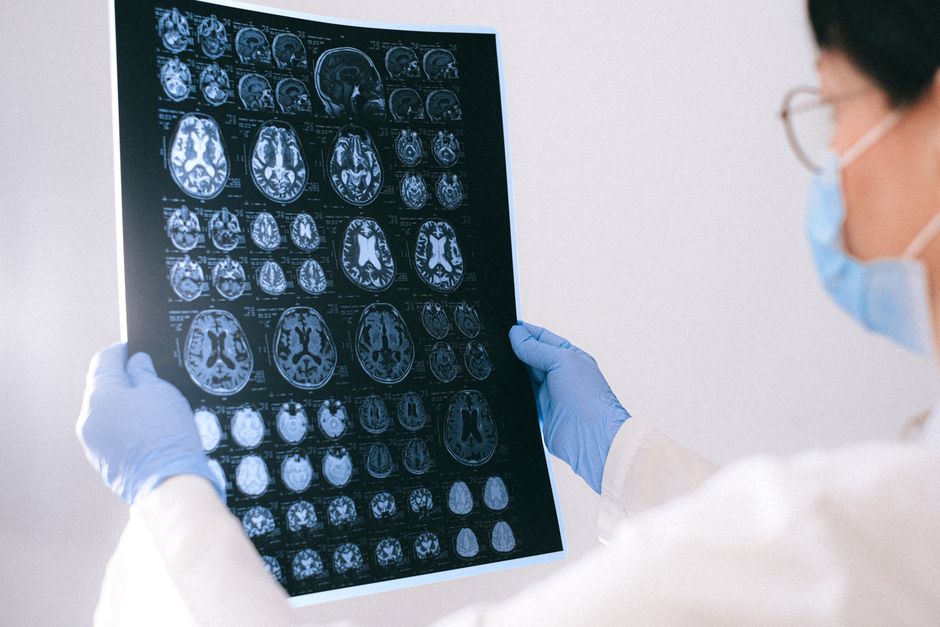 Did You Know? 12 Facts About the Brain