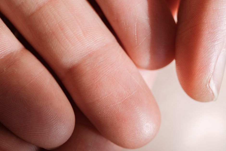 The Truth About Fingerprints: No Two Are Ever Identical