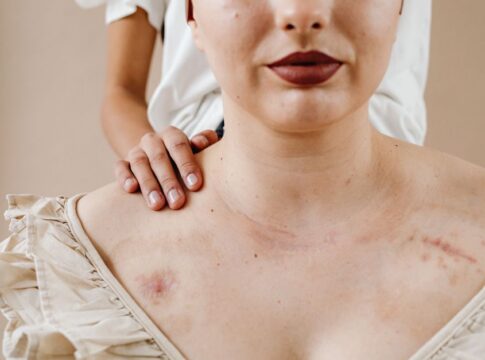 Why Lightning Scars Create Beautiful Patterns on Skin — Odd Science/Facts trivia by Trivia Daily